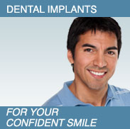 Man smiling - Dental Implants.  For your confident smile