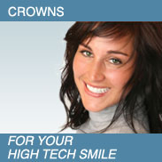 Women smiling - Crowns.  For your high tech smile